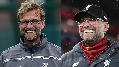 The Liverpool manager had a gnashers transformation ever since he became a client of Dr Robert Hughes