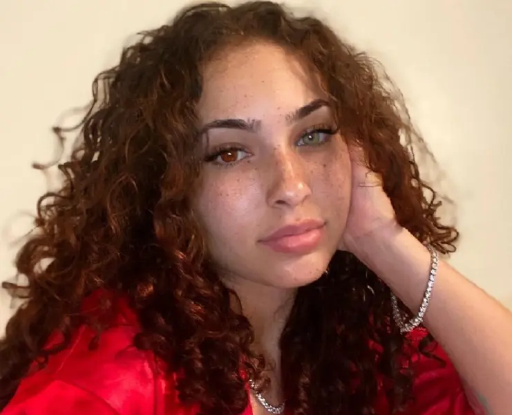 Who Is @Ashaley.Nucole On TikTok? Ash Kaash Before Surgery Pictures